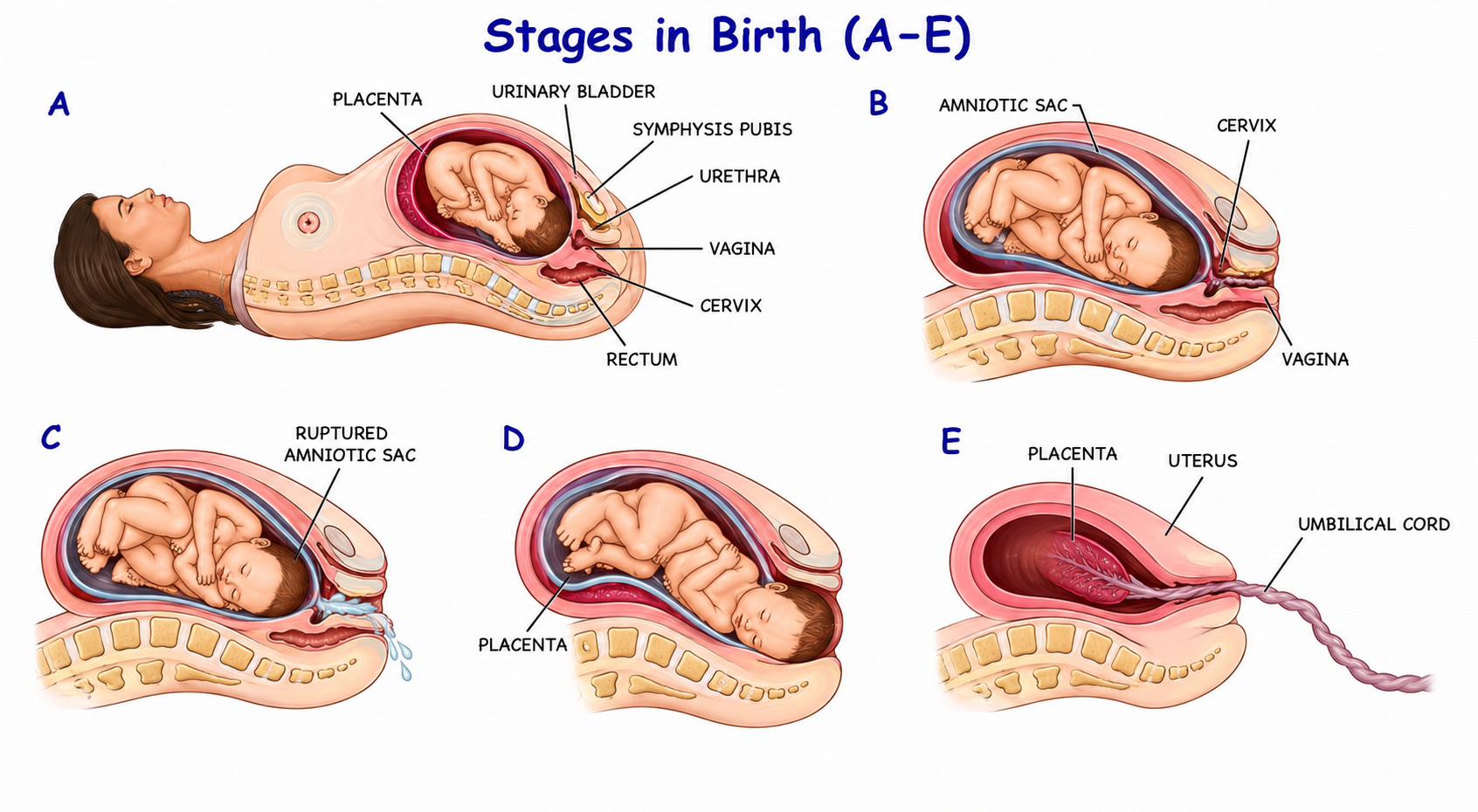 Fig. 11.9 Stages in Birth